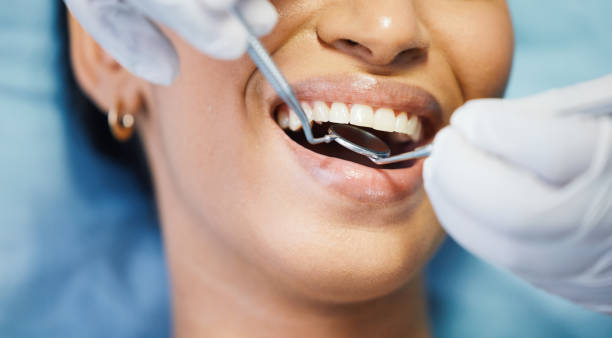 Best Emergency Denture Repair in Flora, IN
