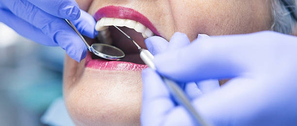 Best Emergency Dental Care for Broken or Chipped Teeth in Flora, IN
